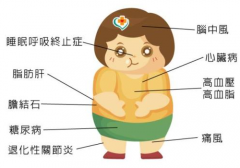 肥胖在医学上的定义，虚胖和真胖的特征区别